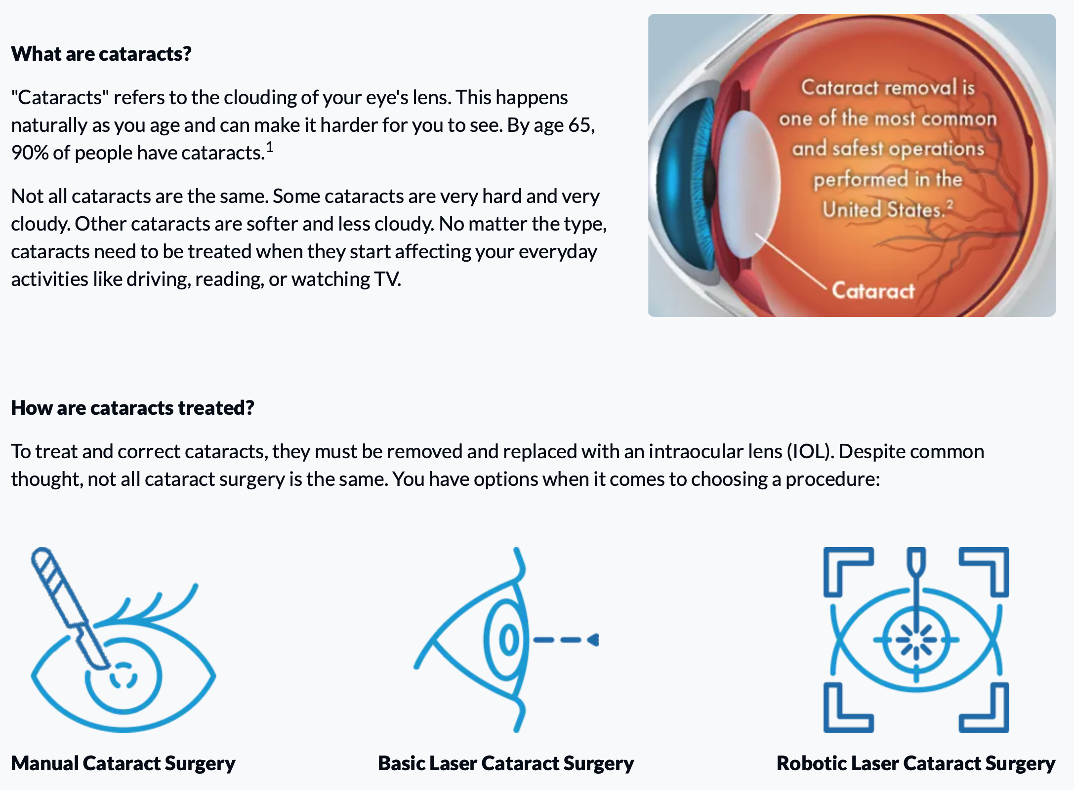 LensAR ALLY robotic cataract surgery comparison chart showing imaging, precision, and patient comfort benefits 